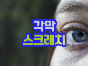 각막 손상 긁힘 찢어짐 찔림