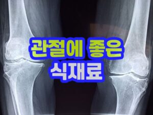 관절염에 좋은 음식