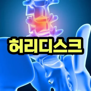 허리 디스크 질환